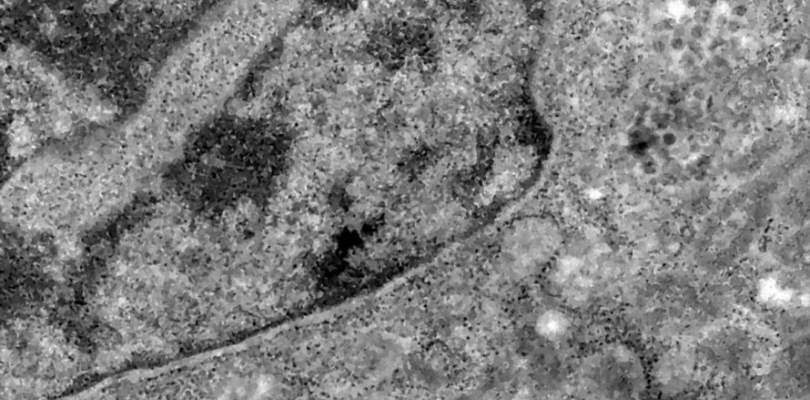 retina