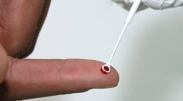 Sesab nega surto de HIV/Aids na Bahia entre jovens
